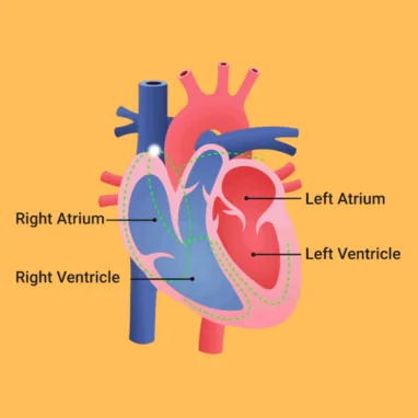 arrhythmia surgery in india