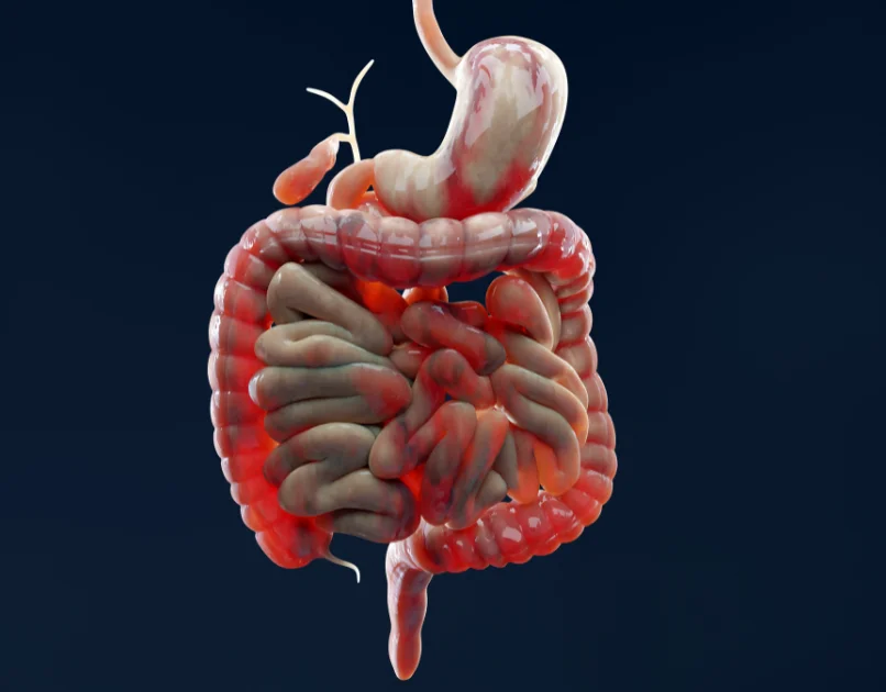 Typhoid