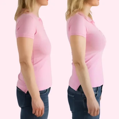 breast augmentation surgery in india