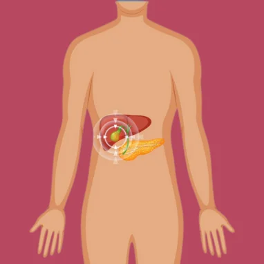 laparoscopic cholecystectomy surgery in india