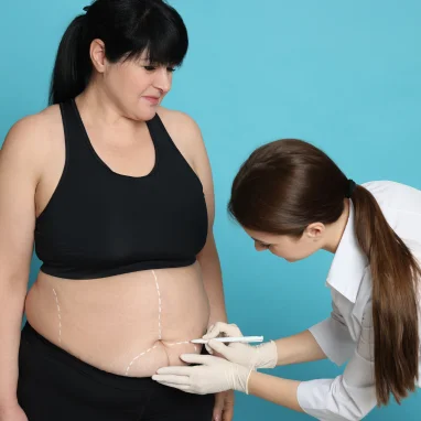 liposuction surgery in india