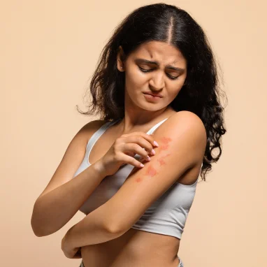 burn reconstruction surgery in india