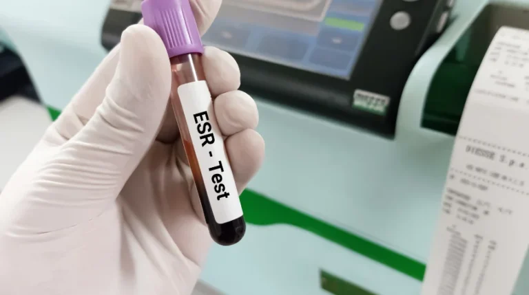 ESR Test | mediSuggest
