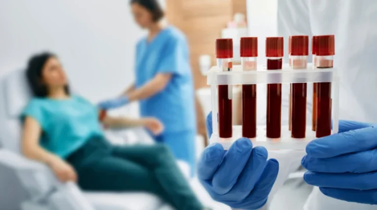 MCV Blood Test 1 | mediSuggest