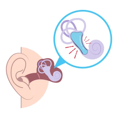 menieres disease treatment in india