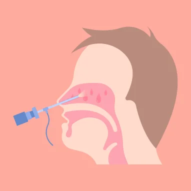 nasal polyps treatment in india