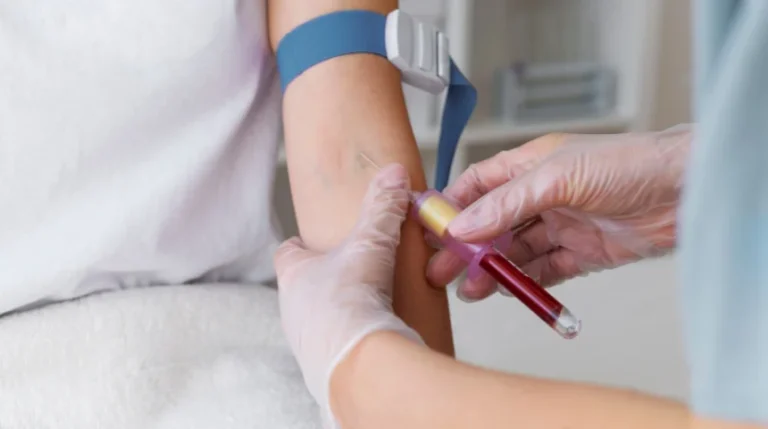 Platelet Count Test | mediSuggest