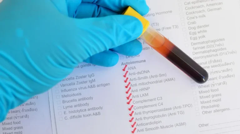 achr antibody