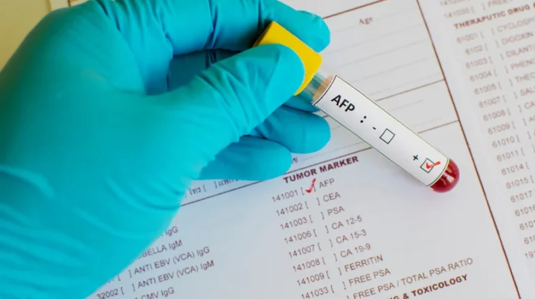 afp test