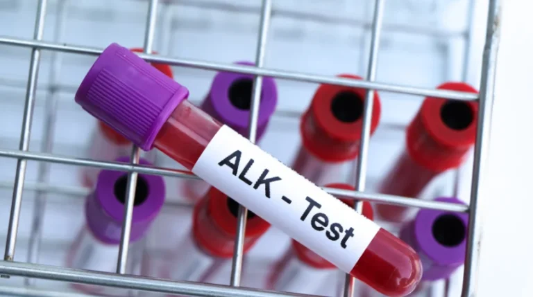 alk mutation test