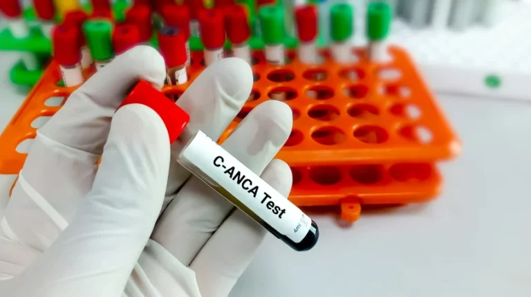 anca test
