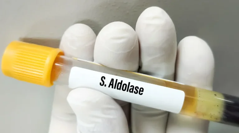 aldolase test