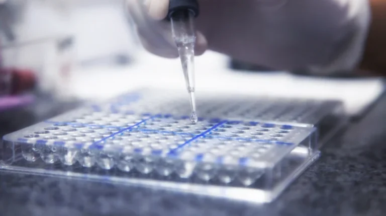 anti-dsdna test