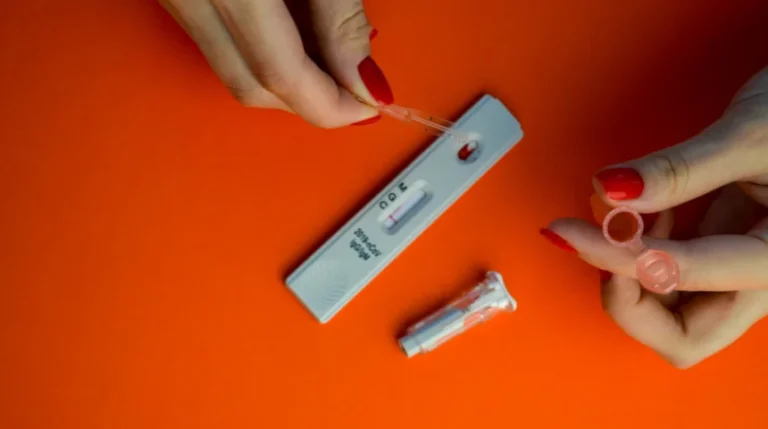 antibody titer test