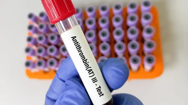 Antithrombin Test | mediSuggest