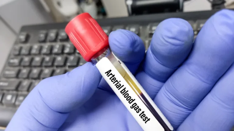 arterial blood gas test