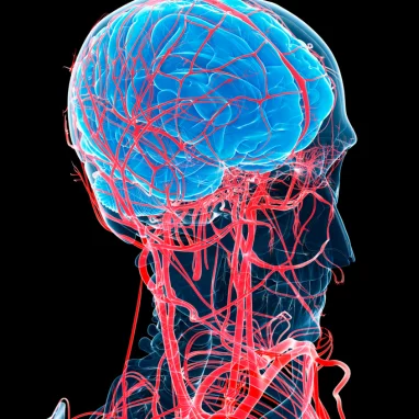 arteriovenous malformation surgery