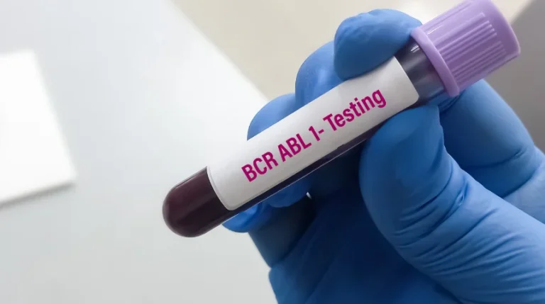 bcr-abl1 test