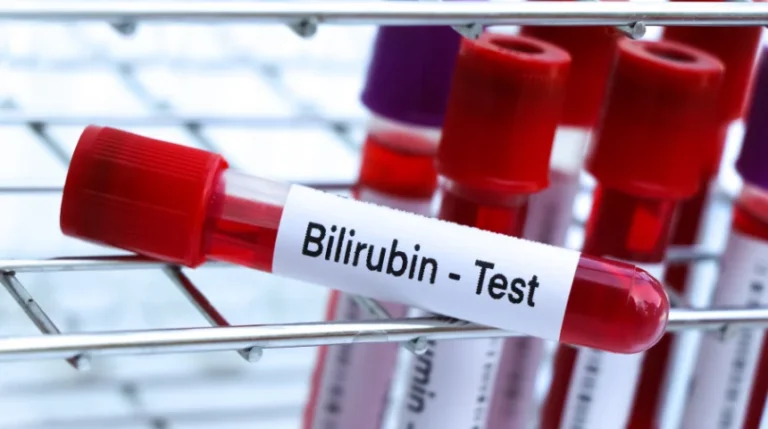 bilirubin test