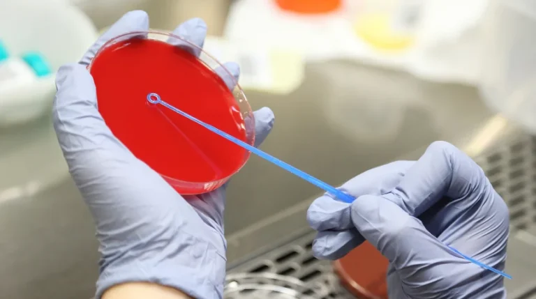 blood culture test