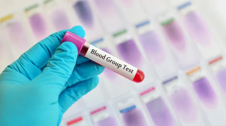 Blood Group Test