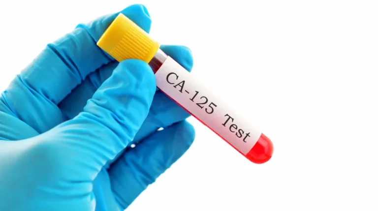 CA 125 Test | mediSuggest