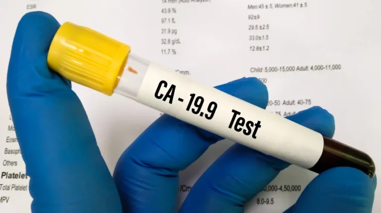 ca 19-9 test