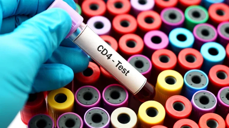 cd4 count