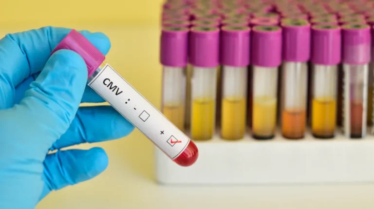 cmv blood test
