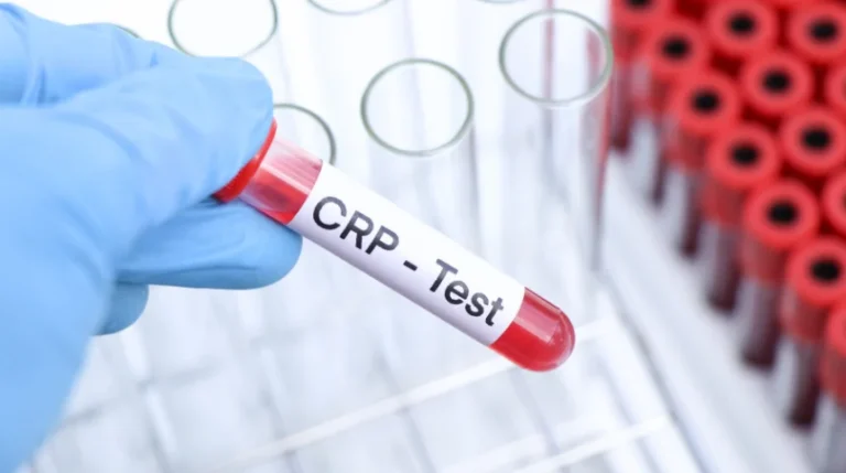 CRP Test | mediSuggest