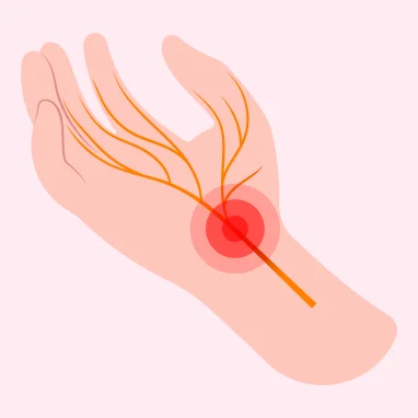 Typhoid