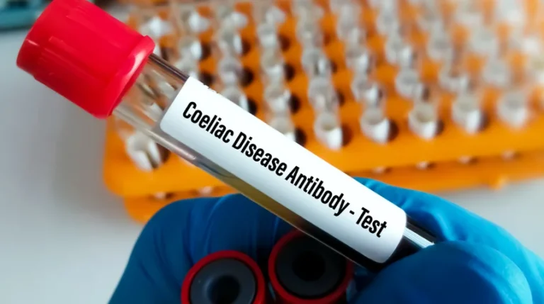 celiac disease antibody