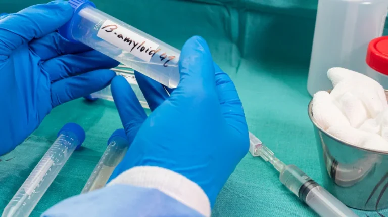 cerebrospinal fluid analysis