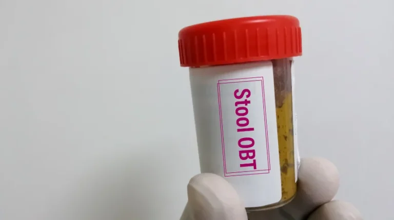 clostridium difficile toxin test