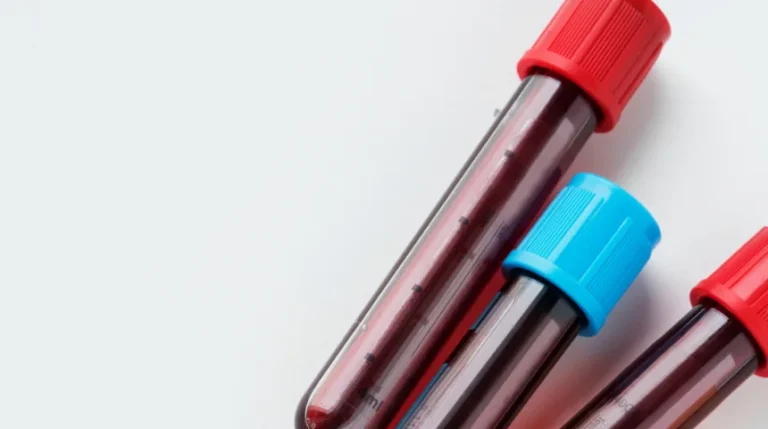 Clot Retraction Time Test | mediSuggest