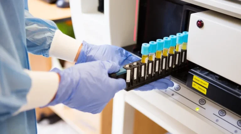 Coagulation Profile Test | mediSuggest