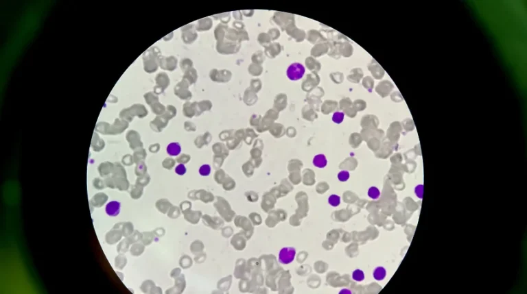 cold agglutinins