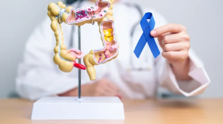 colon biopsy