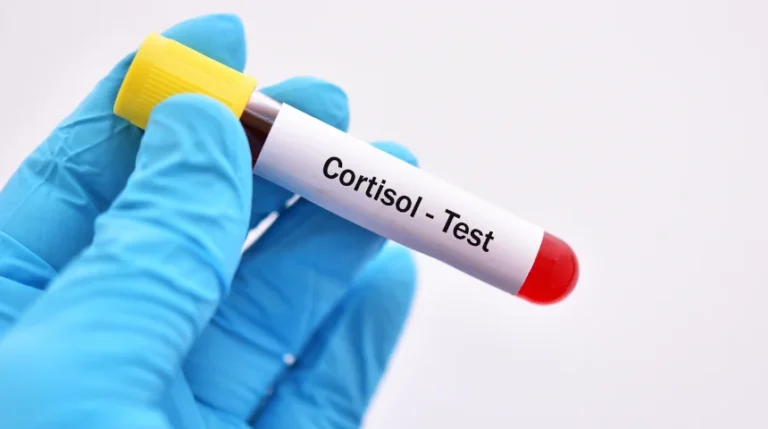 cortisol test