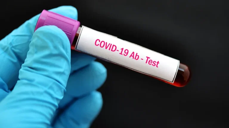 covid-19 antibody test