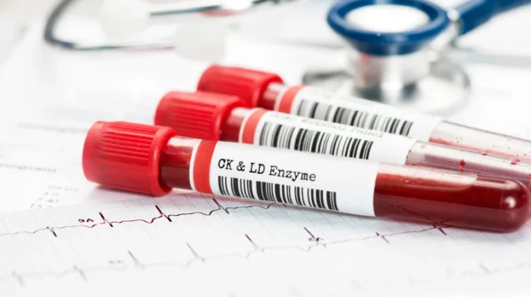 Creatine Kinase Test | mediSuggest