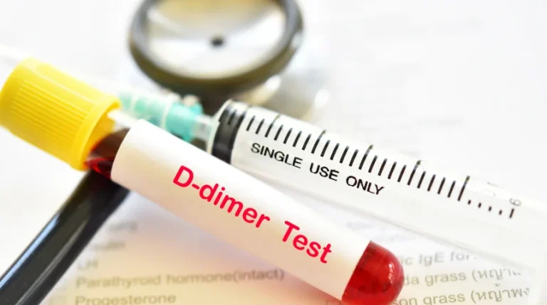 D Dimer Test | mediSuggest