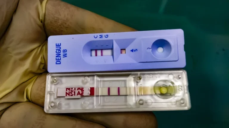 dengue igm test