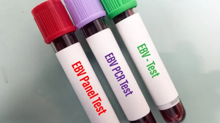 ebv antibody