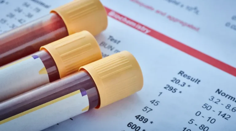 Factor IX Test | mediSuggest