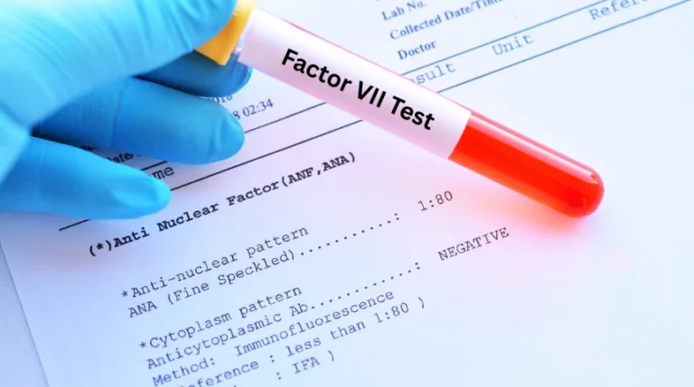 Factor VII Test | mediSuggest