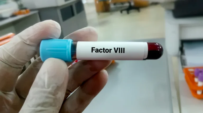 Factor VIII Test | mediSuggest