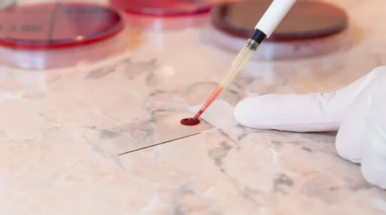 Factor XI Deficiency Test | mediSuggest
