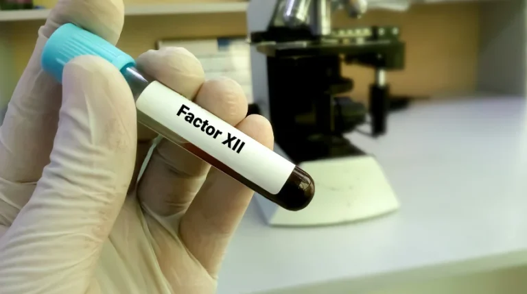 Factor XII Test | mediSuggest