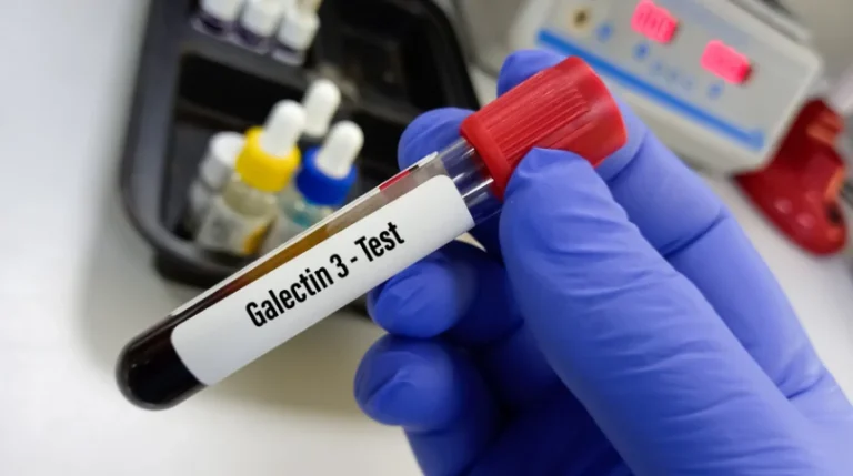 galectin-3 blood test